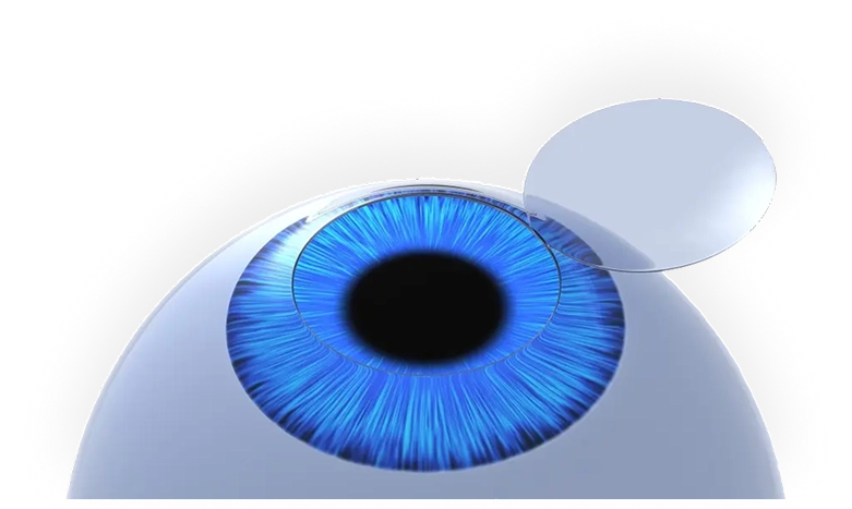 Lasik & Vision Correction